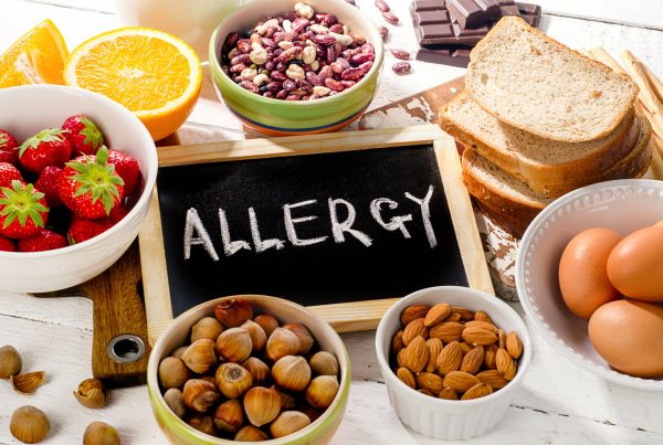 آزمایش آلرژی غذایی