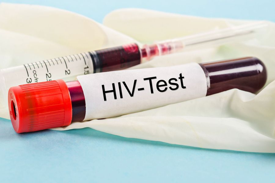 آیا انجام آزمایش HIV ضروری است؟